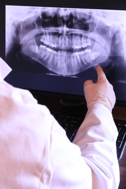 Best Broken or Cracked Tooth Emergency Dentist in Arroyo Grande, CA